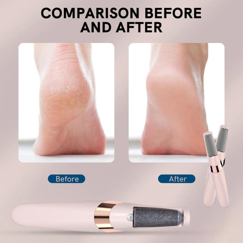 Soft Touch Foot Care for Feet You'll Love to Show Off