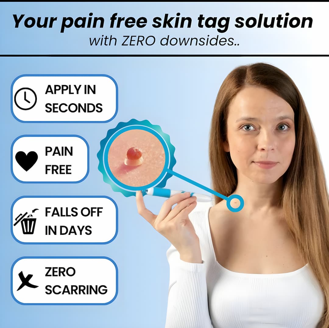 DermaLift™ — Experience Painless Skin Tag Freedom and Radiate Confidence Quickly