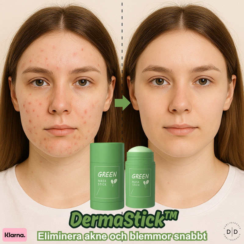 LumaPure™ — Clear Away Acne Fast and Own Your Confident Glow