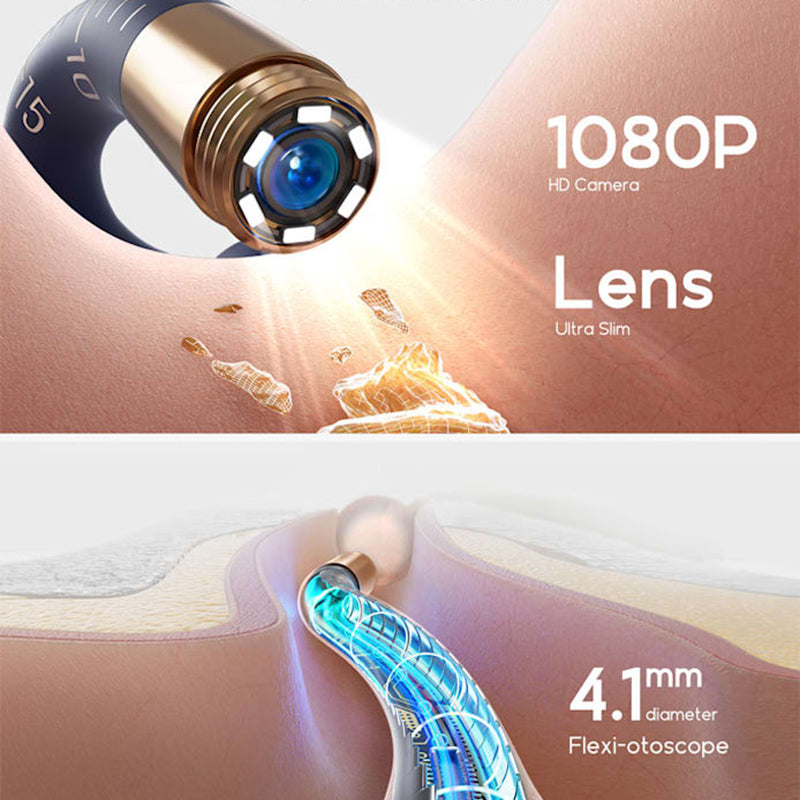 Gentle Ear Care with Safety and Full Control – AurixVue
