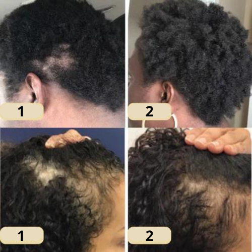 RevitaTress™ — Ignite Your Hair’s Power with Thick, Lush Growth in 45 Days