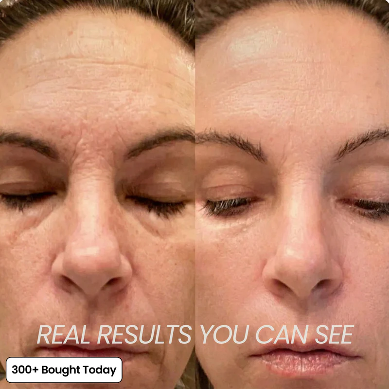 Her+ Calcium™ — Swipe Away Wrinkles, Smile Lines & Tired Under-Eyes In Seconds