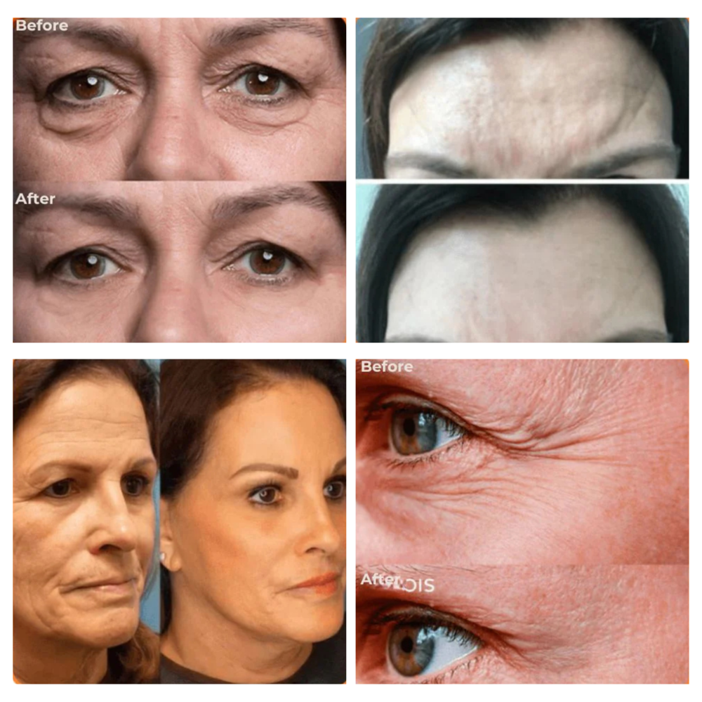 PerfectSync™ — Erase Fine Lines & Glow Naturally | 1+1 FREE Today