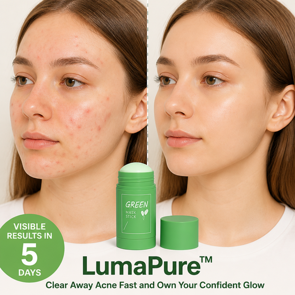 LumaPure™ — Clear Away Acne Fast and Own Your Confident Glow