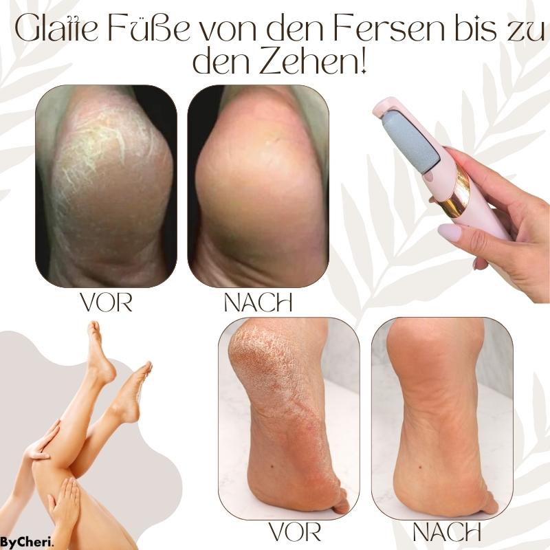 PediLuxe™ — Effortlessly Enjoy Soft, Smooth Feet That Boost Your Confidence