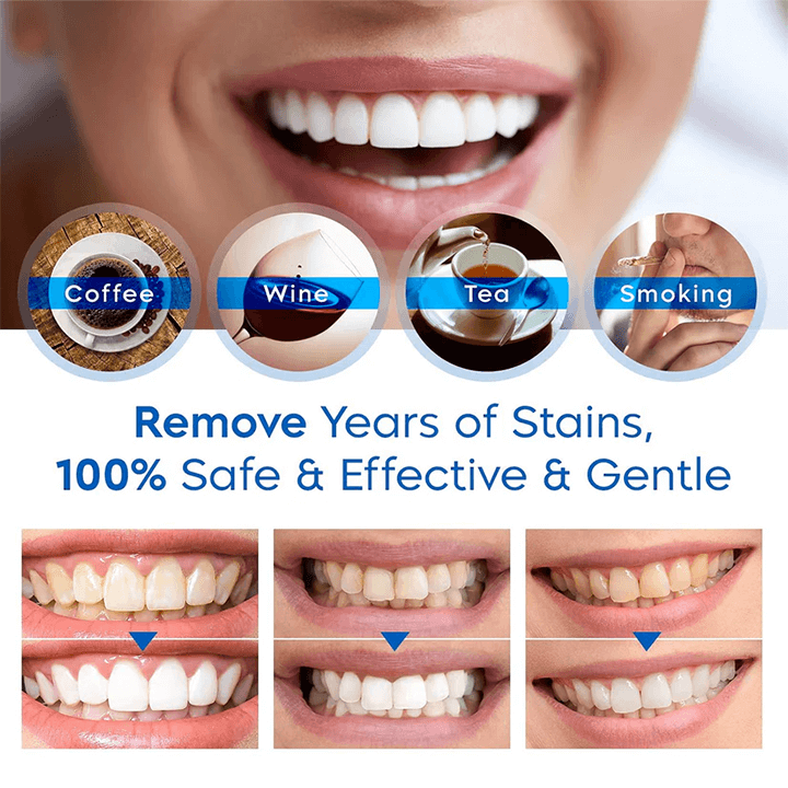 RadiantPearl™ Whitening Essence — Brighten Your Smile with Gentle, Head-Turning Confidence