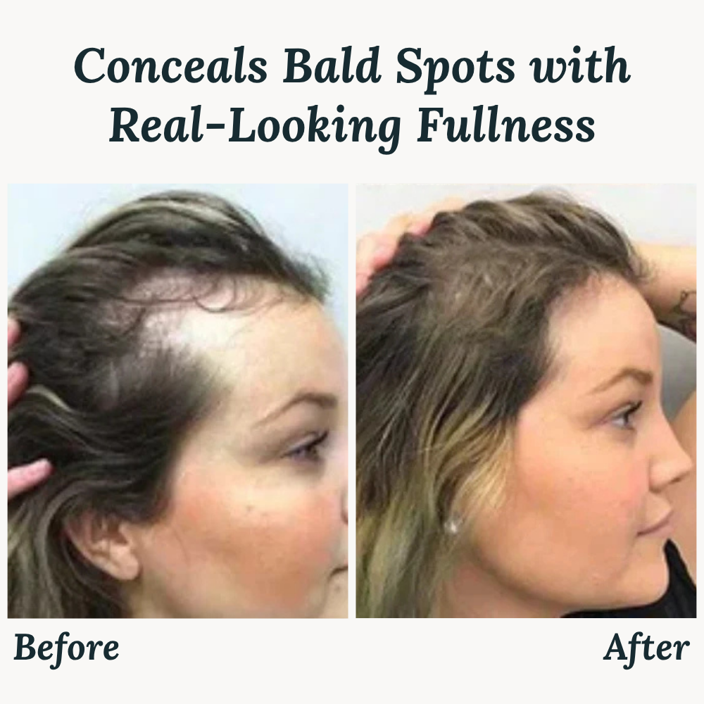 ThickFuse™ — Explode Your Hair’s Fullness and Confidence Instantly