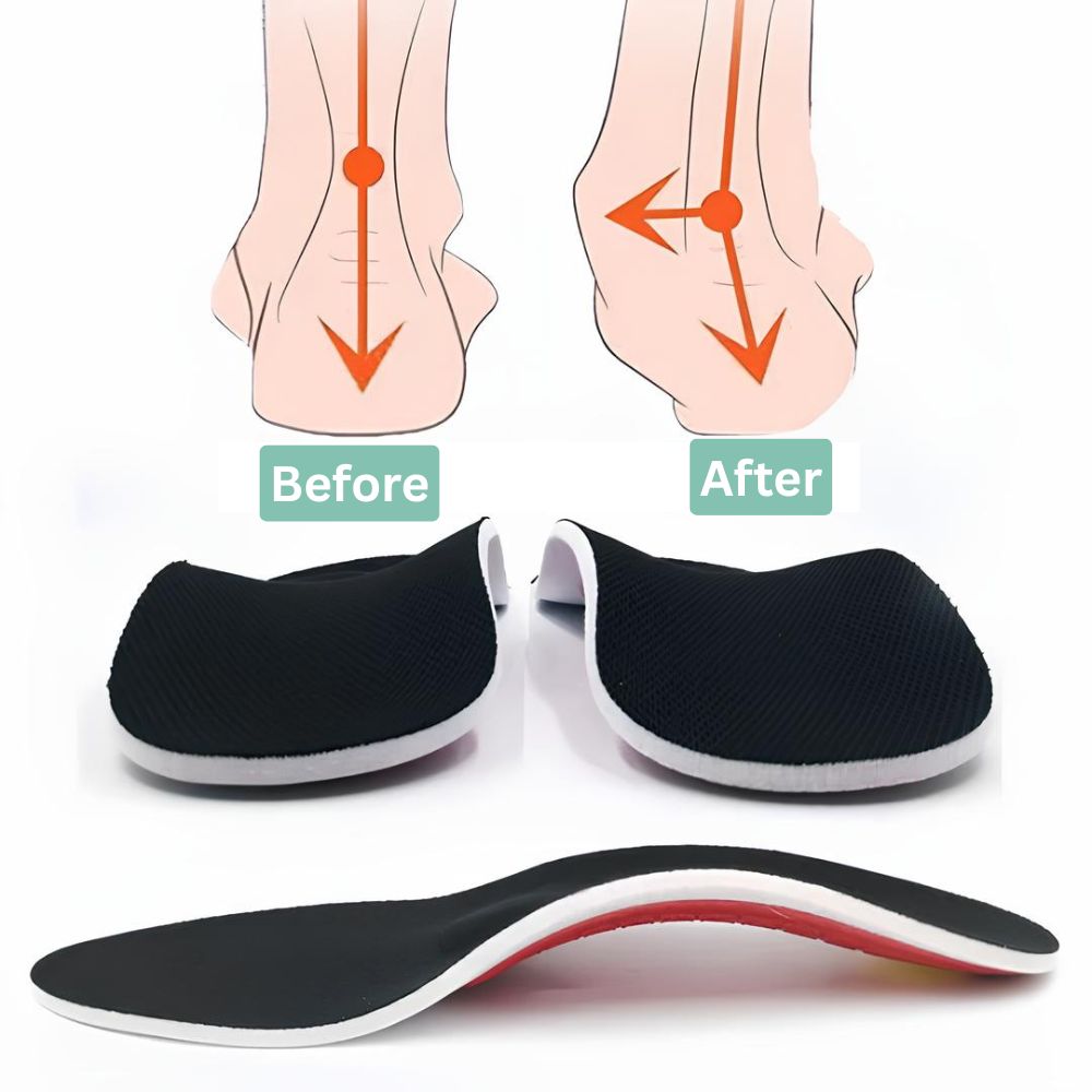 ArchEase™ - Orthopedic Arch Support Insole (1+1 FREE - 2 Pairs)