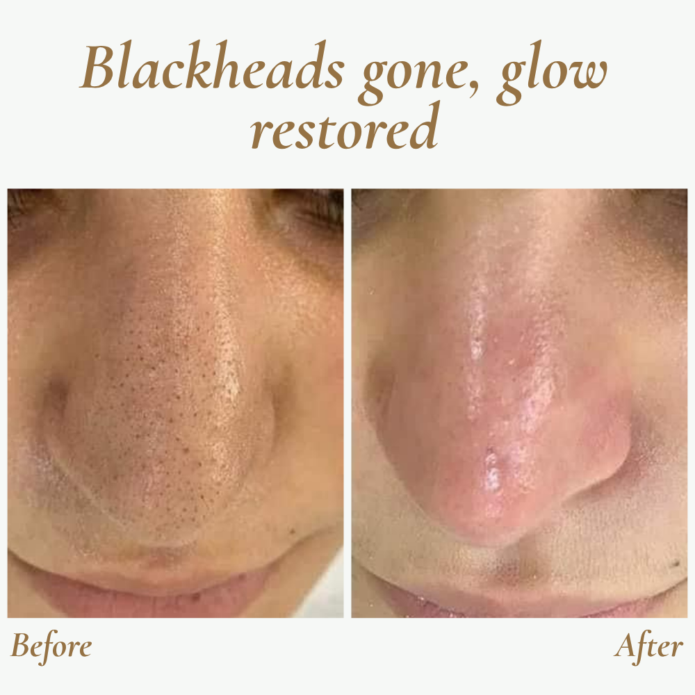 SkinPulse™ - Professional Ultrasonic Skin Cleansing