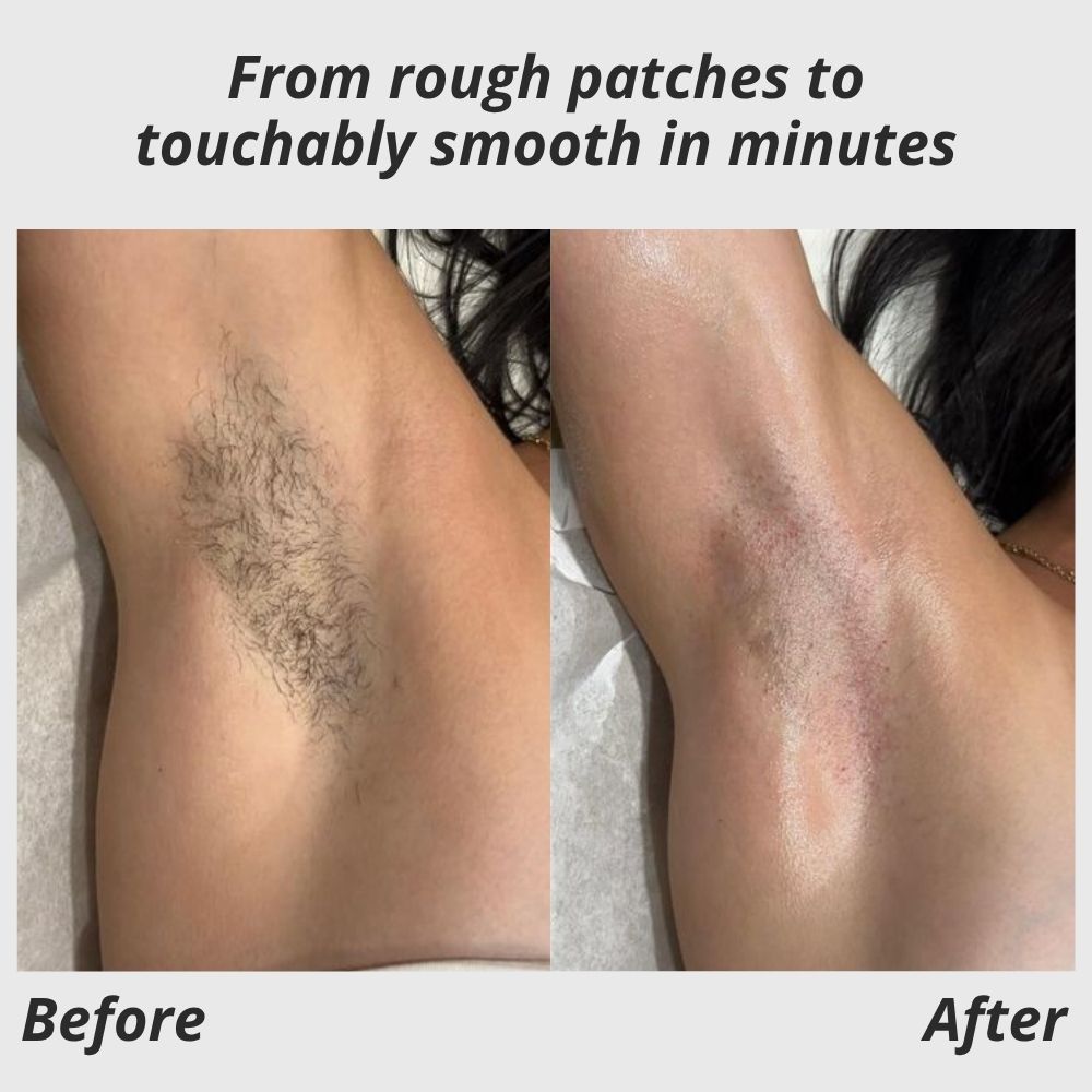 SilkySmooth Epilator™ — Effortless, Pain-Free Glow That Empowers Your Confidence