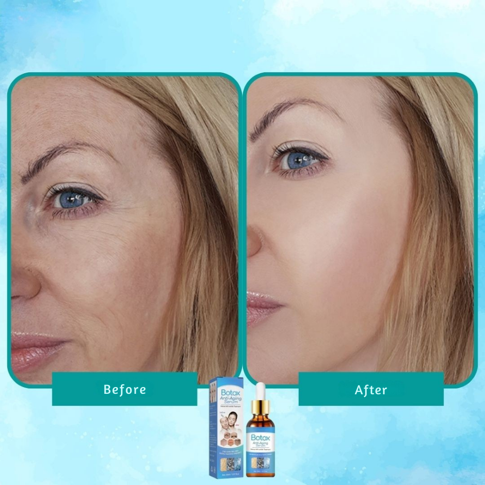 YouthGlow™ — Botox-Like Results Without Needles | 1+1 FREE TODAY