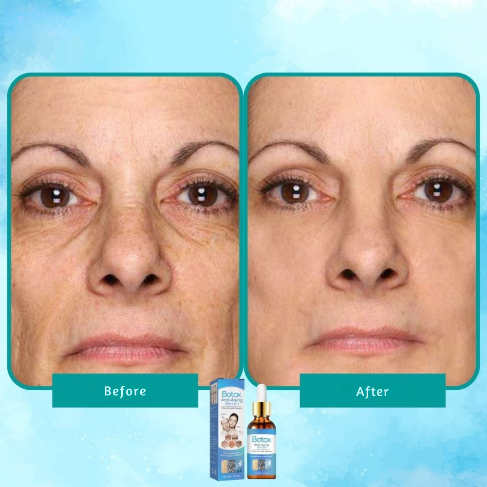YouthGlow™ — Botox-Like Results Without Needles | 1+1 FREE TODAY