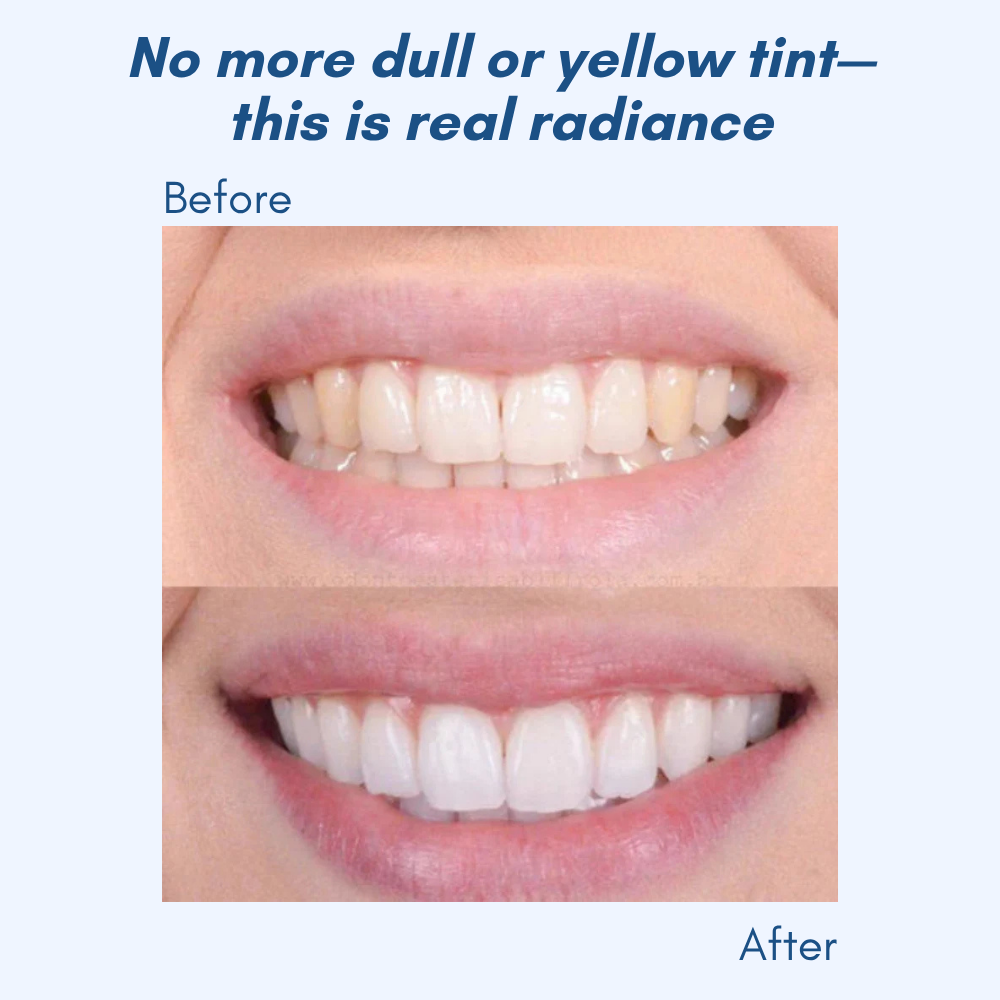 LumaShine™ — Glow Brighter Instantly with a Comfortable, Confidence-Boosting Smile
