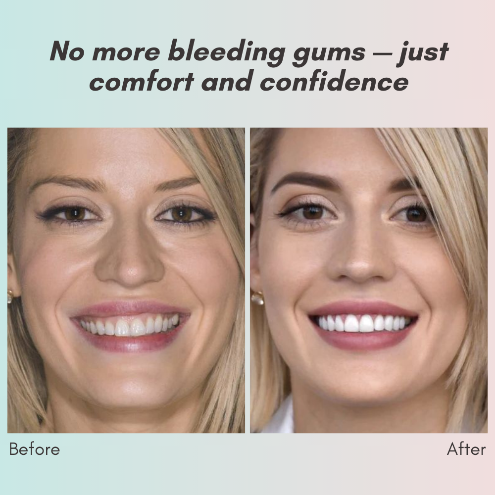 LumaCrest™ — Unleash a Radiant Smile and Heal Your Gums for Lasting Confidence