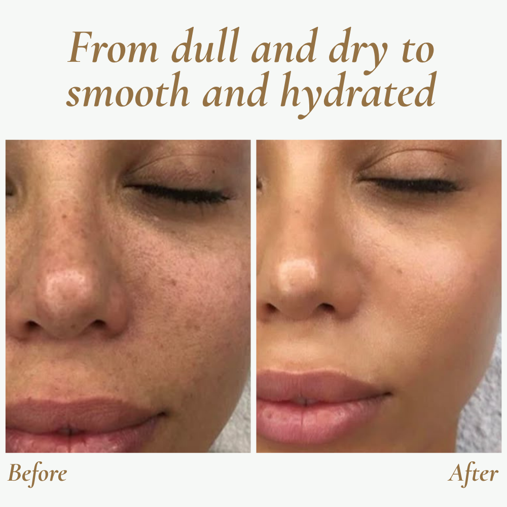 SkinPulse™ - Professional Ultrasonic Skin Cleansing