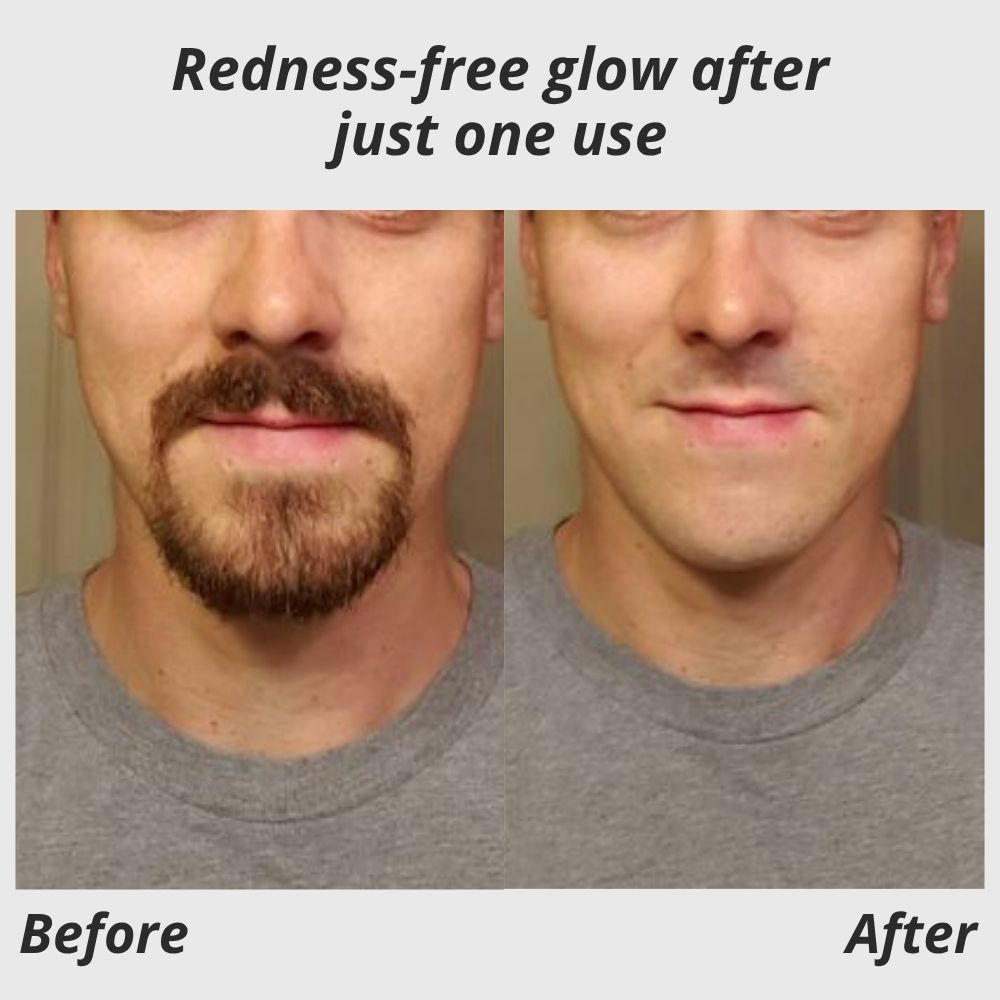 SilkySmooth Epilator™ — Effortless, Pain-Free Glow That Empowers Your Confidence