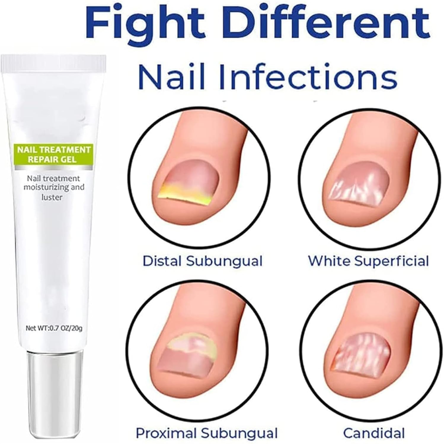 VitaNail™ — Heal and Strengthen Nails Fast for Head-Turning Confidence