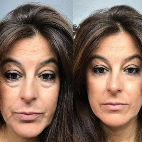 RambleaLift™ — Instantly Restore Youthful, Radiant Eyes That Stop Time