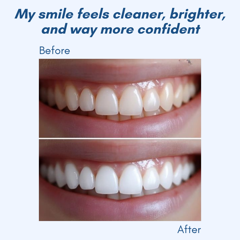 LumaShine™ — Glow Brighter Instantly with a Comfortable, Confidence-Boosting Smile