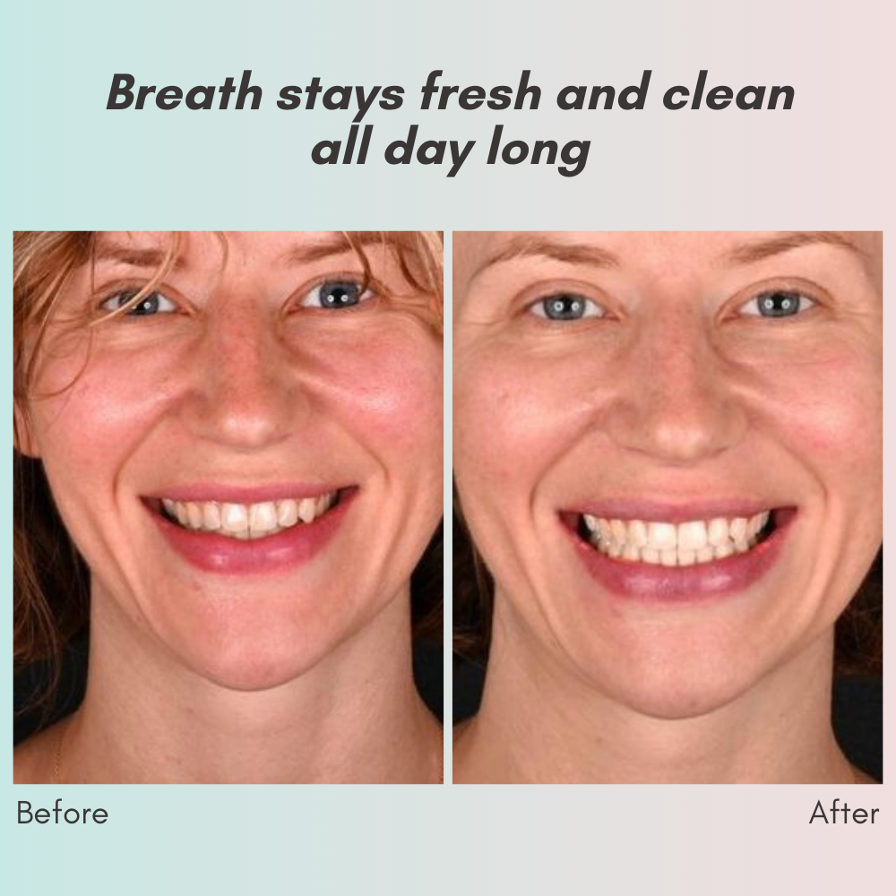 LumaCrest™ — Unleash a Radiant Smile and Heal Your Gums for Lasting Confidence