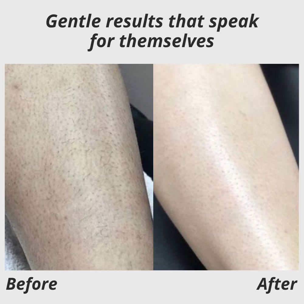 SilkySmooth Epilator™ — Effortless, Pain-Free Glow That Empowers Your Confidence