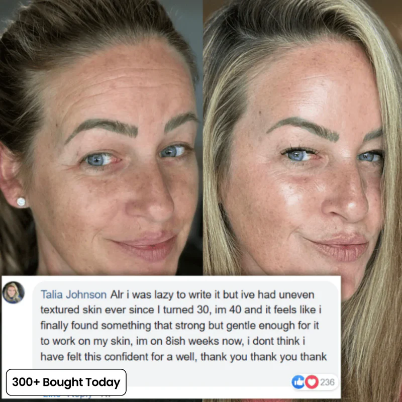 Her+ Calcium™ — Swipe Away Wrinkles, Smile Lines & Tired Under-Eyes In Seconds