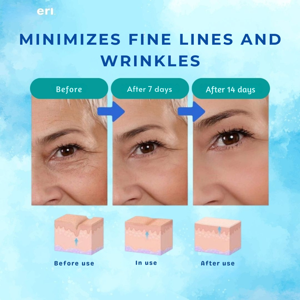 YouthGlow™ — Botox-Like Results Without Needles | 1+1 FREE TODAY