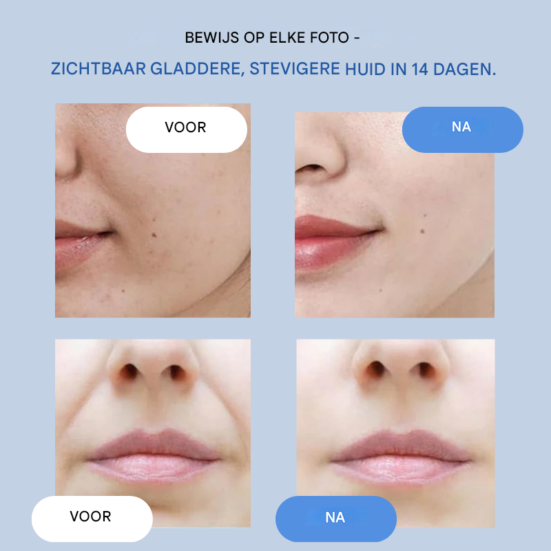 VivaLift™ Precision Strips — Turn Back Time with an Instant, Invisible Lift That Revives Your Youthful Glow