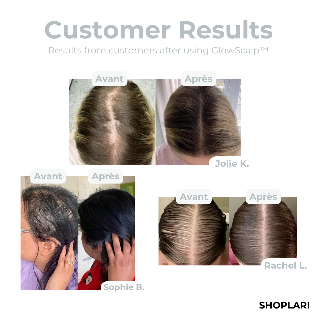 VioraLume™ — Revive Your Hair, Calm Your Mind, and Shine with Confidence