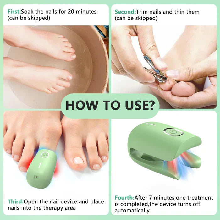 Onychomycosis Treatment Device for Nail Fungus Removal