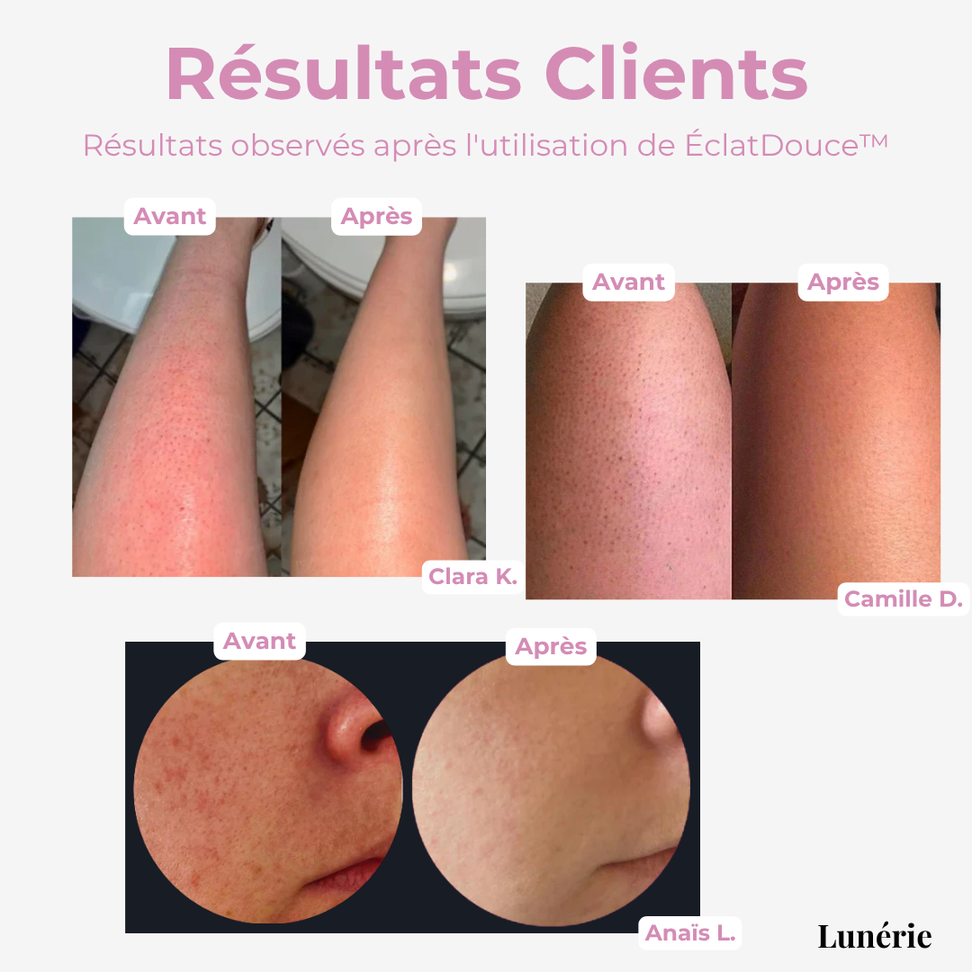 LumiAura™ — Unlock Silky, Radiant Skin That Feels Like Pure Confidence