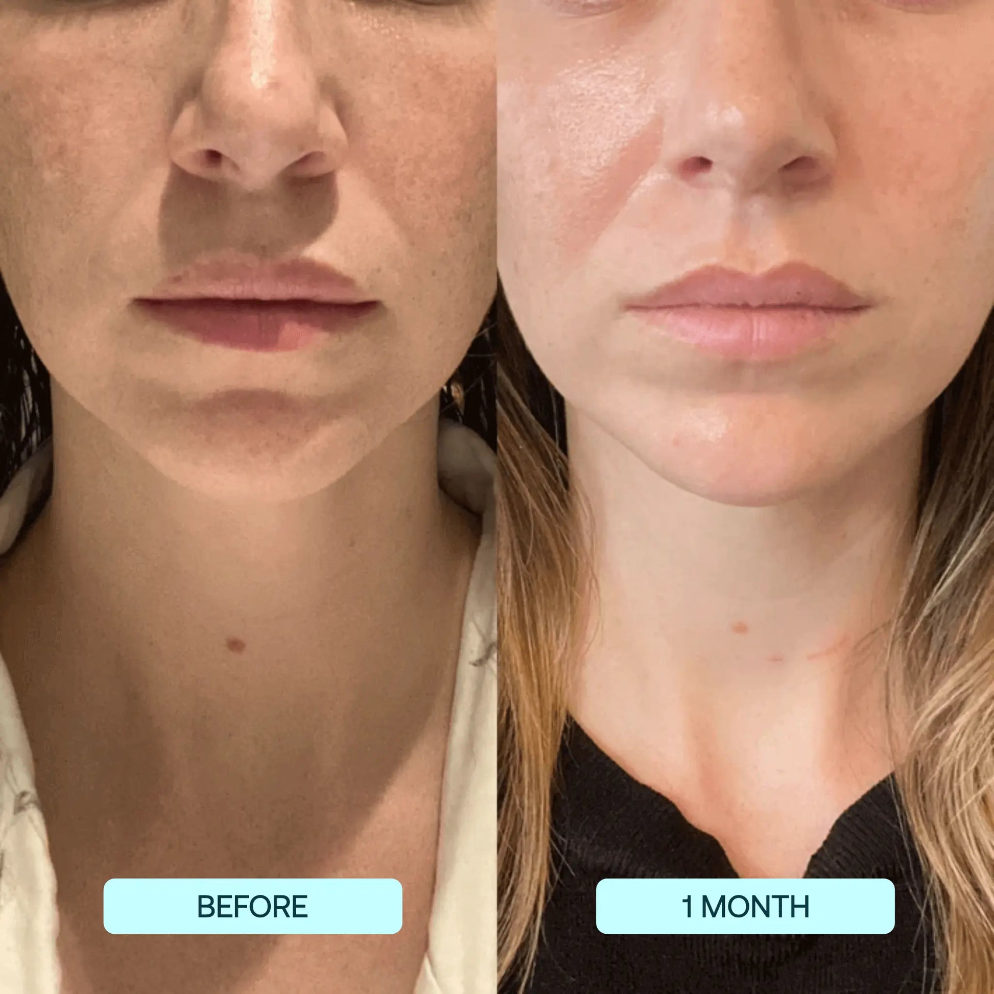 RadianceRise™ — Reveal Youthful, Glowing Skin with Effortless Firmness