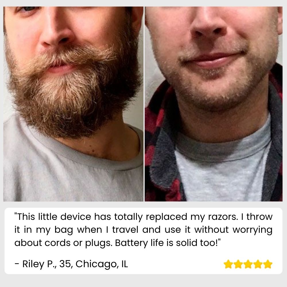 SilkySmooth Epilator™ — Effortless, Pain-Free Glow That Empowers Your Confidence