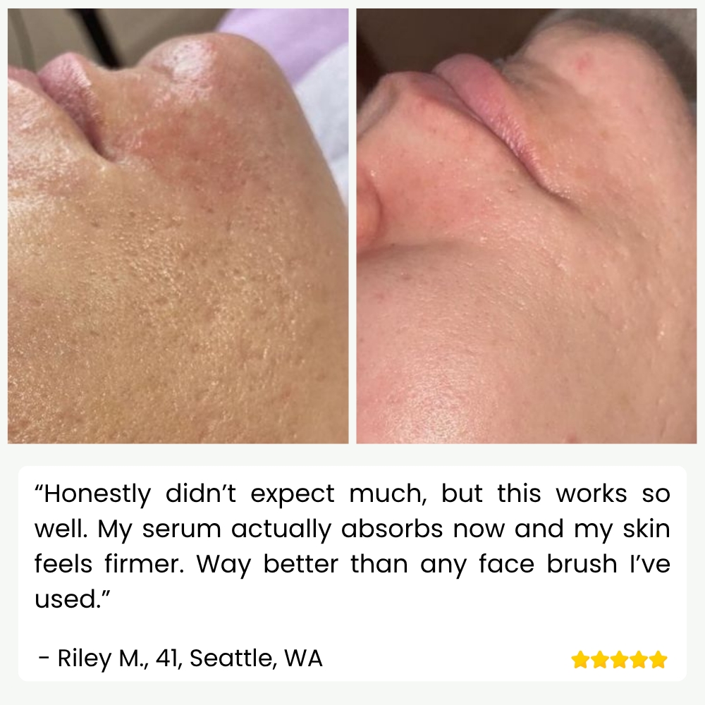 SkinPulse™ - Professional Ultrasonic Skin Cleansing