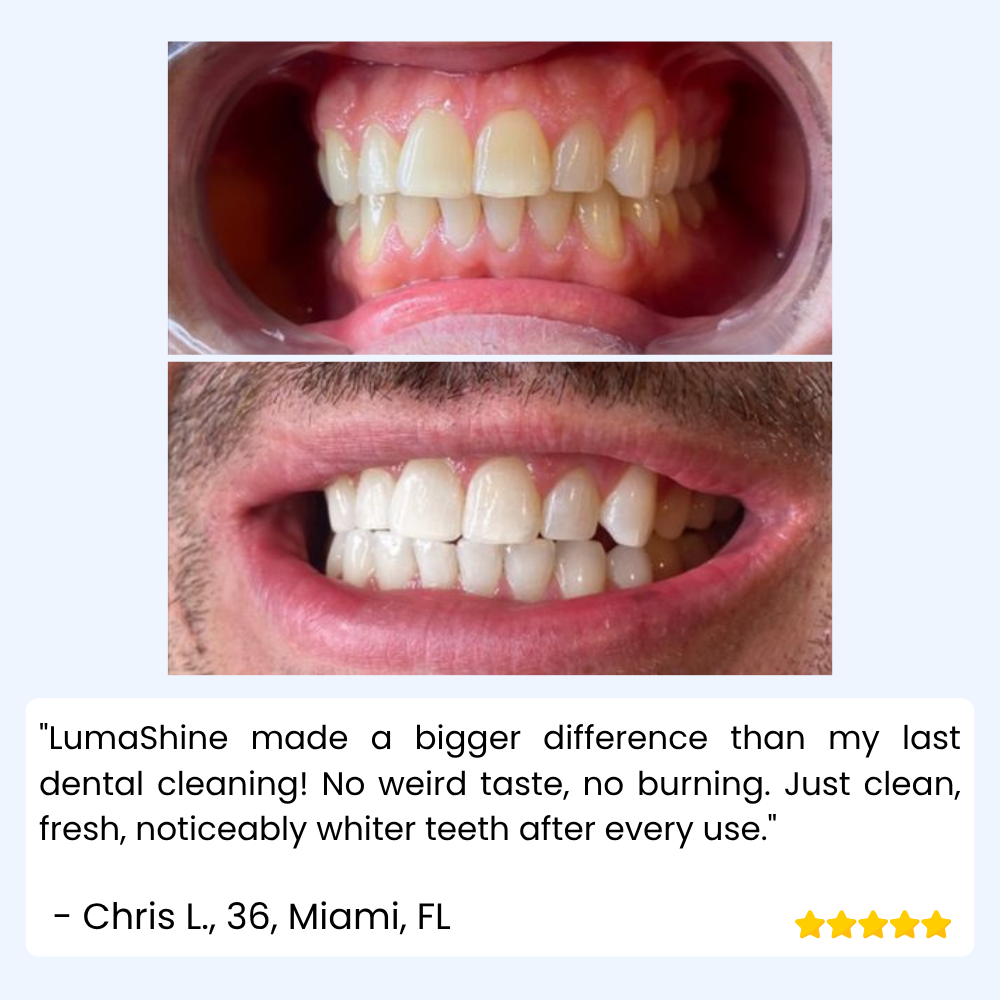LumaShine™ — Glow Brighter Instantly with a Comfortable, Confidence-Boosting Smile