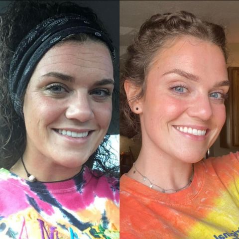 Arvilaro™ - Silicone Scar Sheets