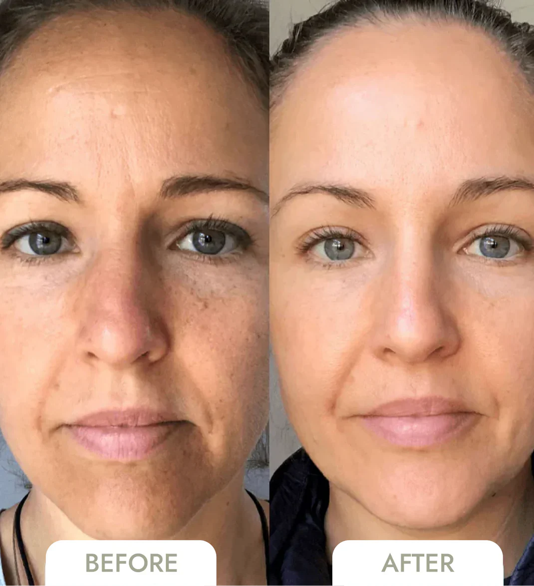 RejuviSkin™ — Unleash Radiant, Youthful Glow That Turns Heads Instantly