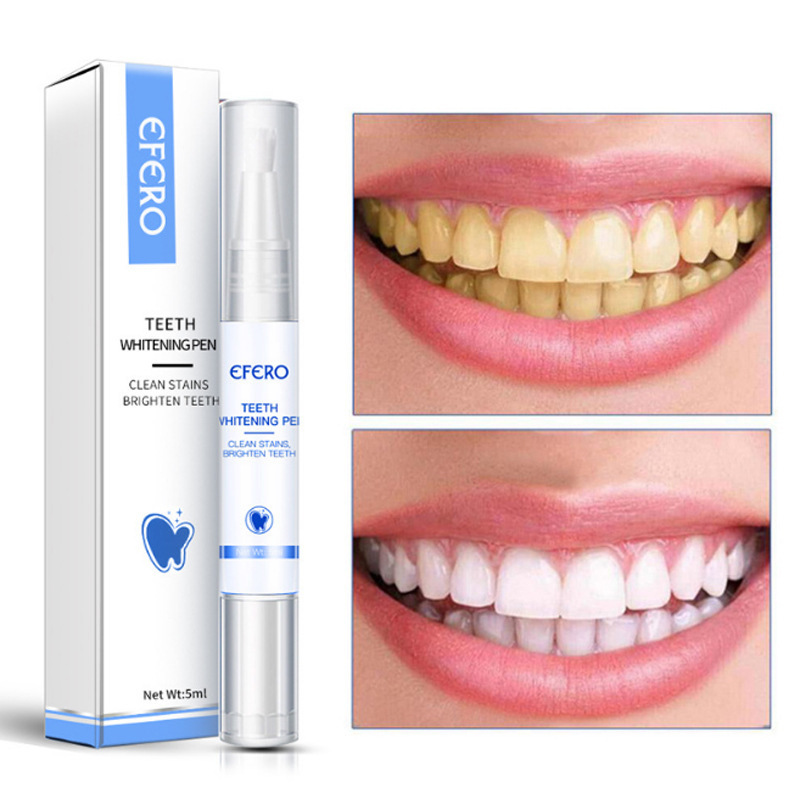 RadiancePro™ Teeth Whitener — Instantly Brighten Your Smile Without Sensitivity