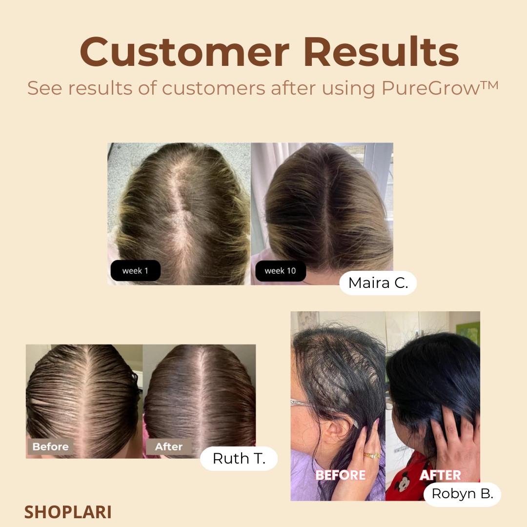 RamoraRevive™ — Unlock Thick, Radiant Hair That Turns Heads