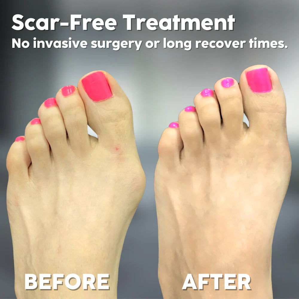 StrideEase™ — Walk Pain-Free with Gentle Toe Realignment You’ll Love Wearing