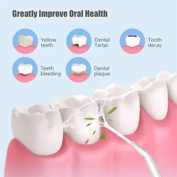 Gentle Plaque Remover for a Bright and Fresh Smile