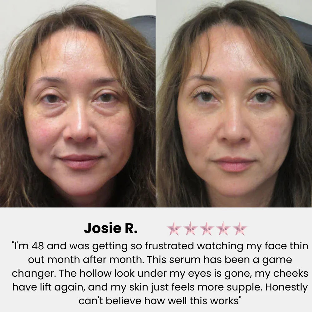 VivaDerm™ — Instantly Lift and Radiate Confidence with Youthful, Plump Skin