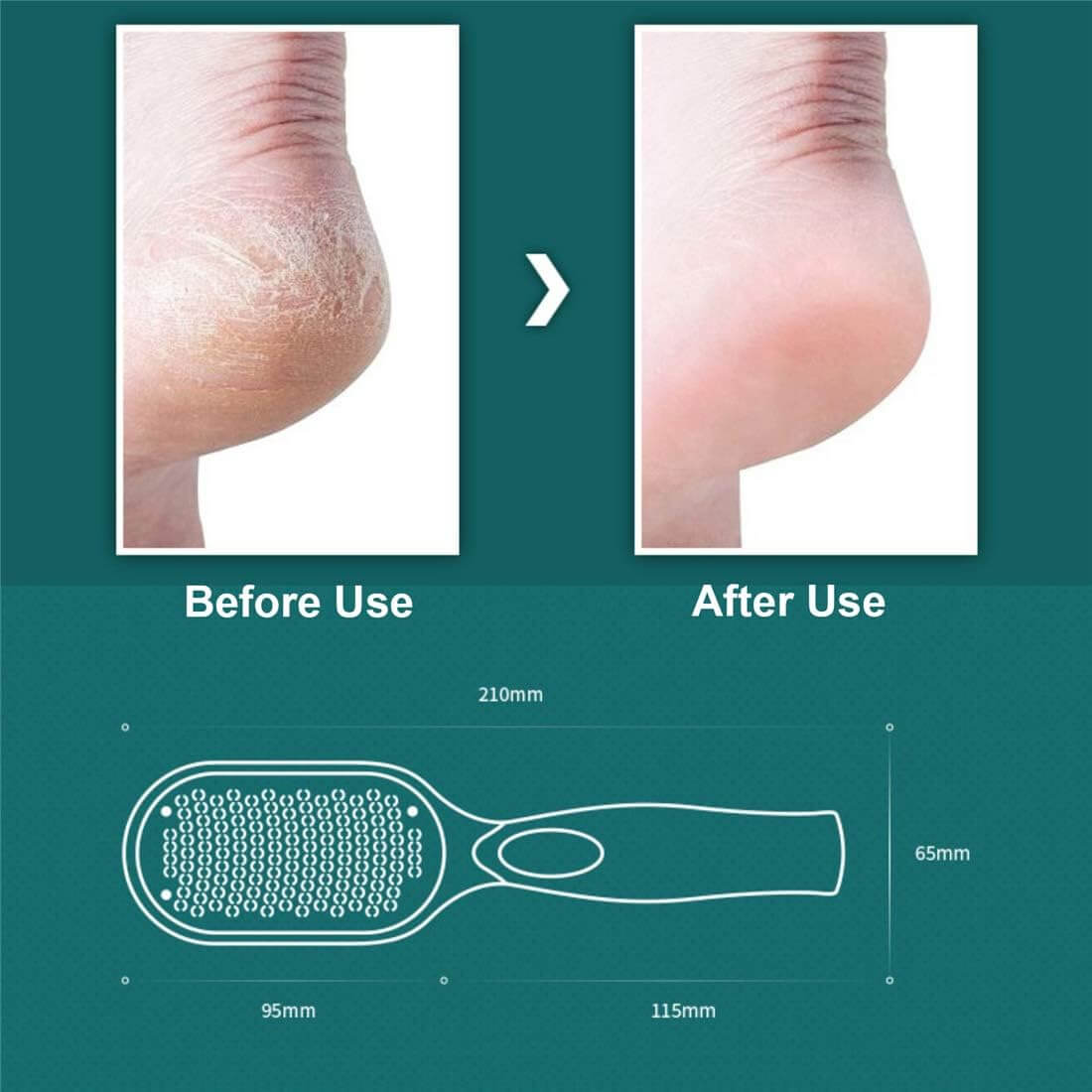 SilkEase™ — Reveal Irresistibly Smooth, Show-Stopper Feet Anytime