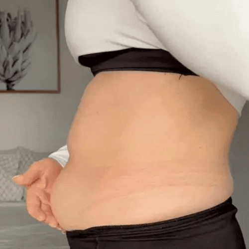 LiftEase™ — Experience the Power of Effortless, All-Day Skin Lifting Confidence