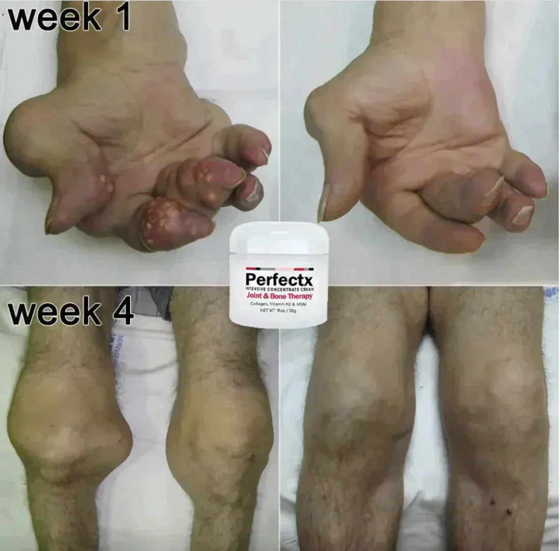 ArthriEase™ — Unlock Effortless Movement and Wave Goodbye to Pain Fast