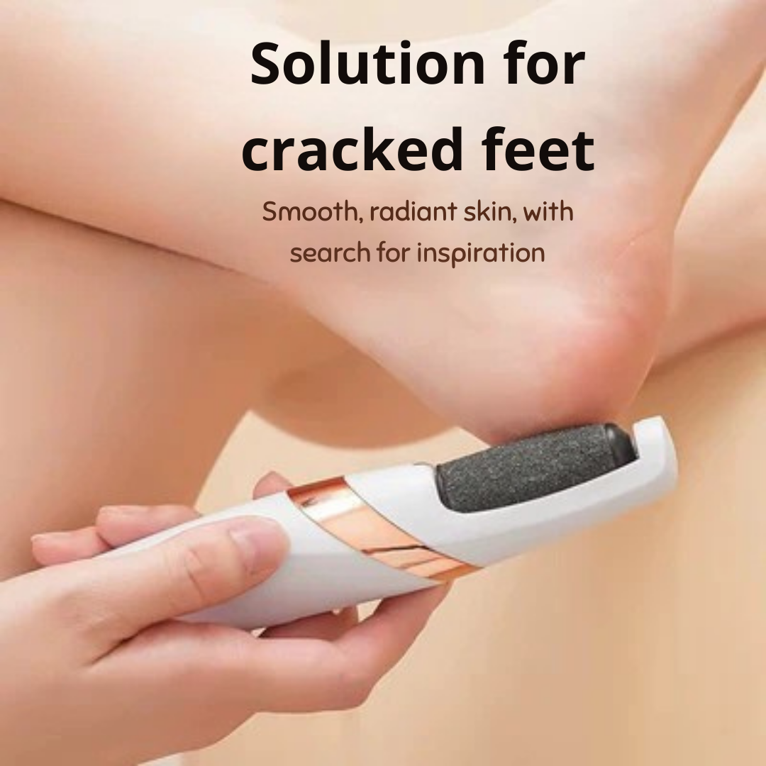 VelveteEase™ — Transform Rough, Cracked Feet into Irresistible Softness You’ll Love to Show Off
