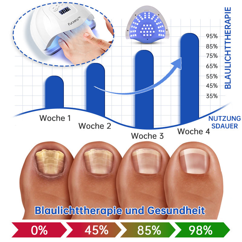 FungiFade™ — Pain-Free Laser Therapy that Restores Gorgeous, Fungus-Free Nails Fast