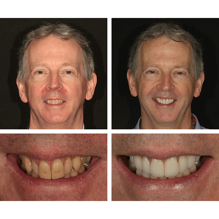 RadiantPearl™ Whitening Essence — Brighten Your Smile with Gentle, Head-Turning Confidence