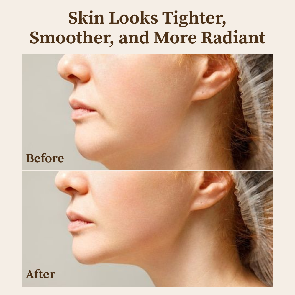 RamoraLift™ — Reveal Youthful, Radiant Skin That Defies Time Instantly