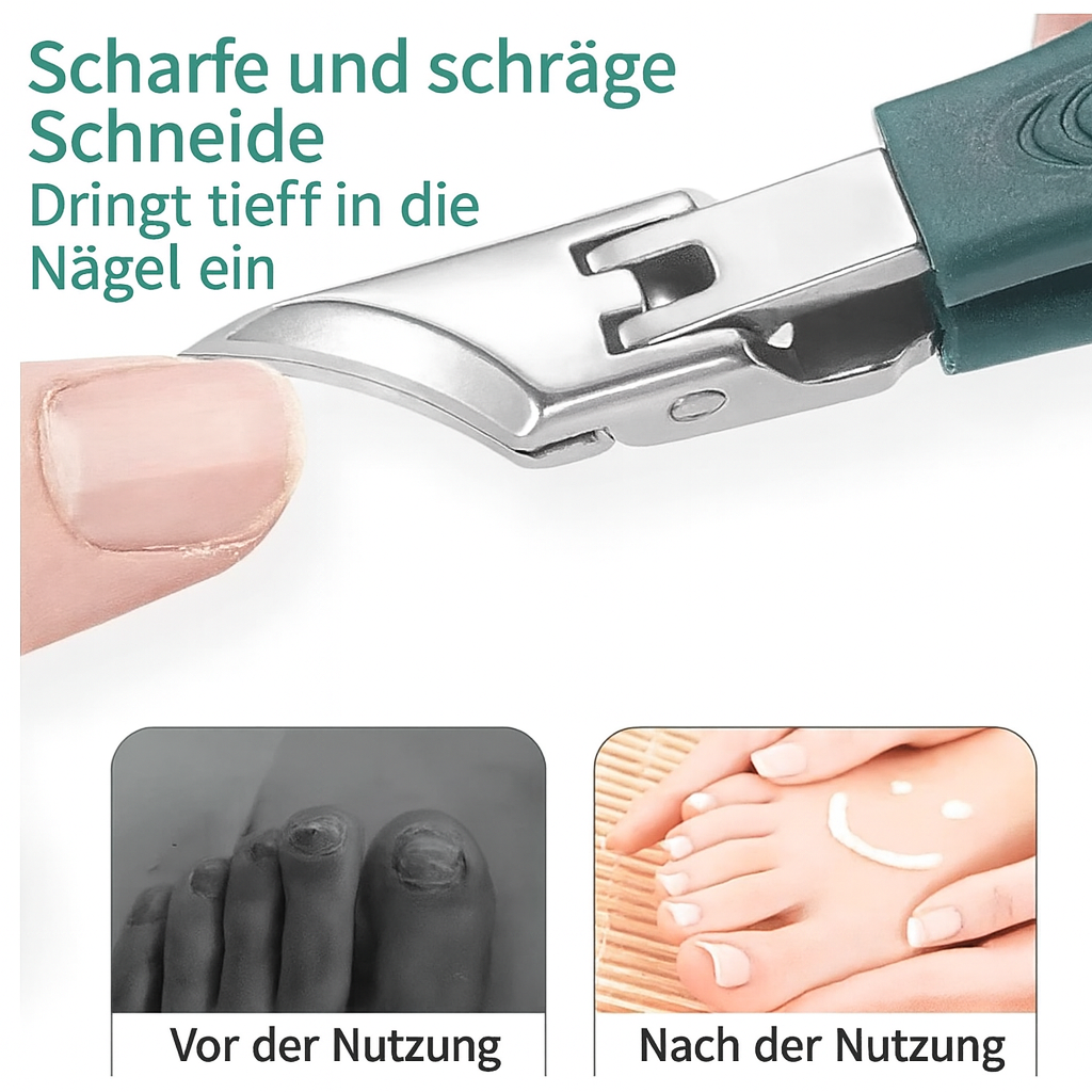 Nail Care Tool for Problematic Nails – Precision Trimmer